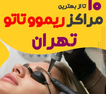 ریموو تاتو در تهران