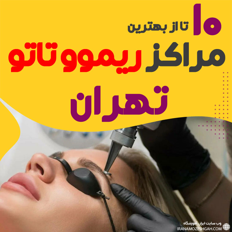 ریموو تاتو در تهران