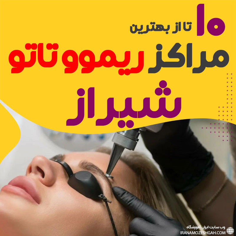 ریموو تاتو در شیراز