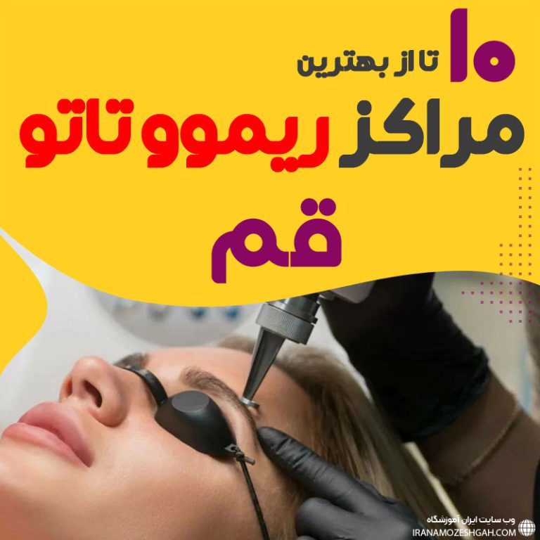 ریموو تاتو در قم