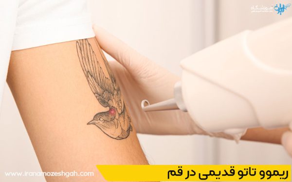 بهترین مراکز آموزش ریموو تاتو در قم