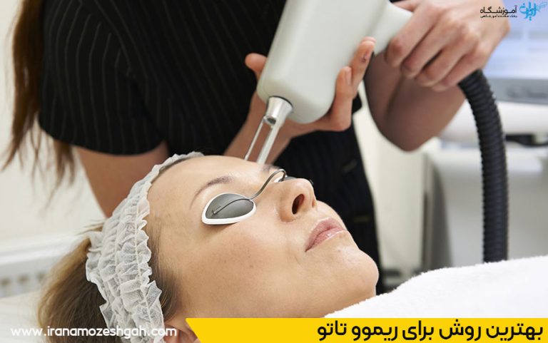 مرکز ریموو تاتو در قم