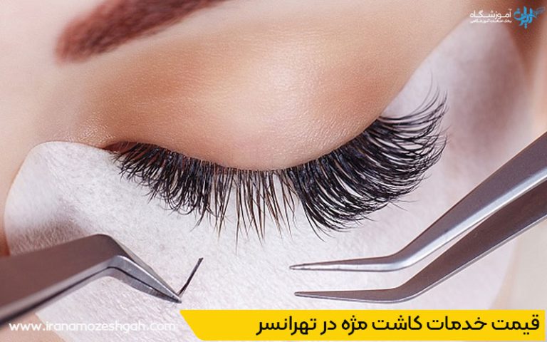 کاشت مژه در تهرانسر