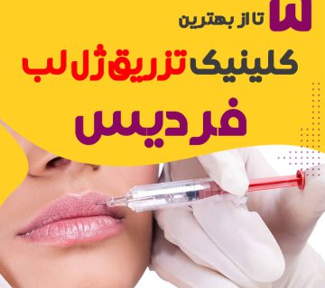 بهترین کلینیک های تزریق ژل لب در فردیس