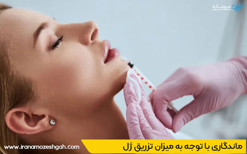 ماندگاری تزریق ژل لب