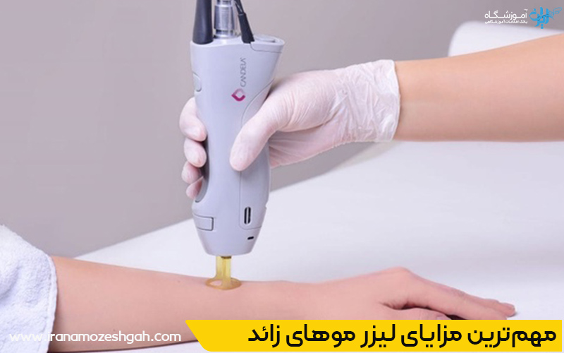 رفع موهای زائد در صادقیه تهران