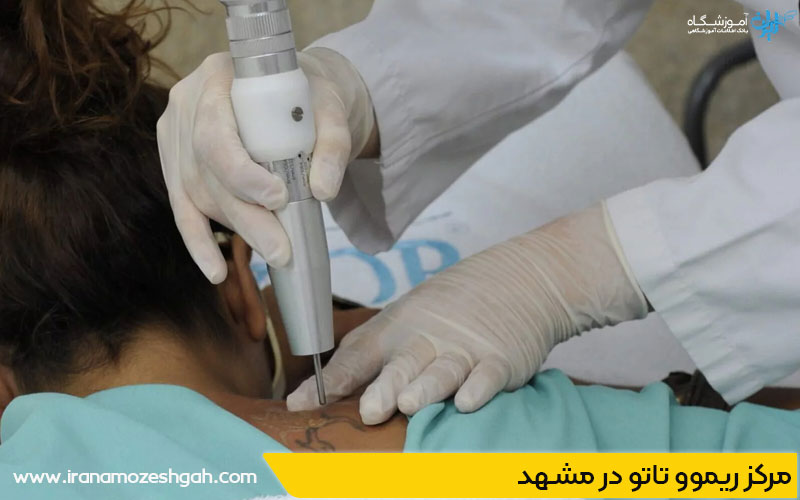 بهترین مرکز ریموو تاتو در مشهد