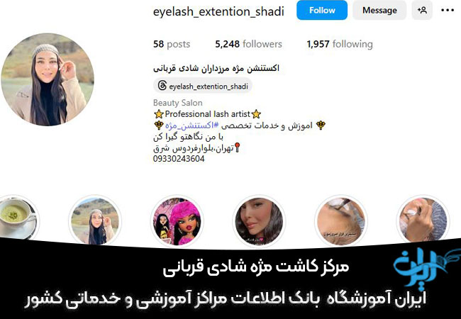 مرکز کاشت مژه شادی قربانی در مرزداران