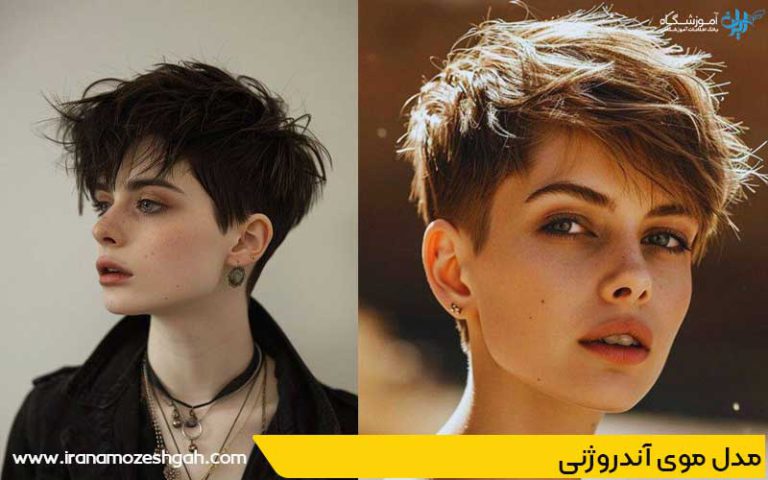 مدل موی آندروژنی با هوش مصنوعی