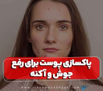 پاکسازی پوست برای رفع جوش و آکنه