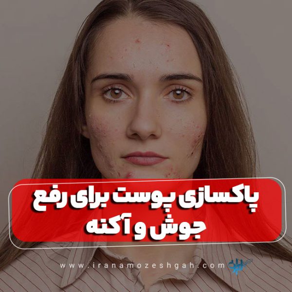 پاکسازی پوست برای رفع جوش و آکنه
