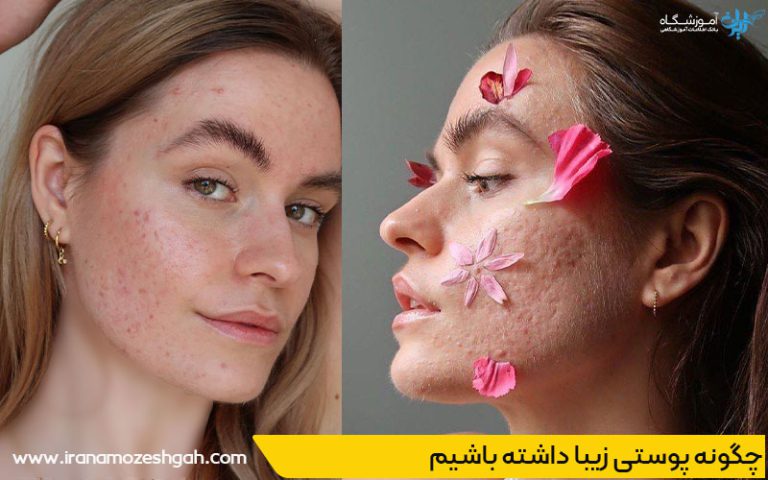 پاکسازی پوست برای رفع جوش و آکنه