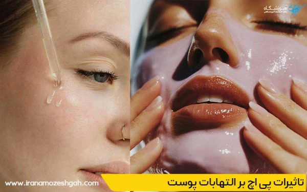 تاثیرات pH بر التهابات پوست