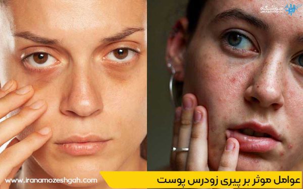 عوامل موثر بر پیری زودرس پوست