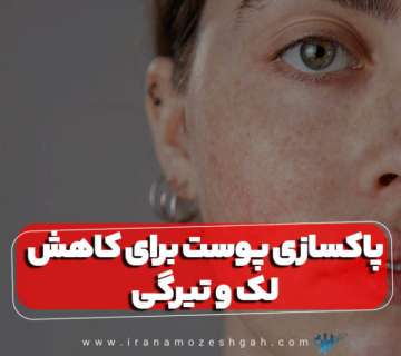 پاکسازی پوست برای کاهش لک و تیرگی