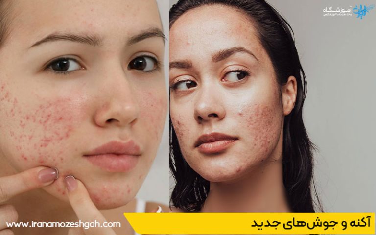 اثرات جانبی احتمالی پاکسازی پوست