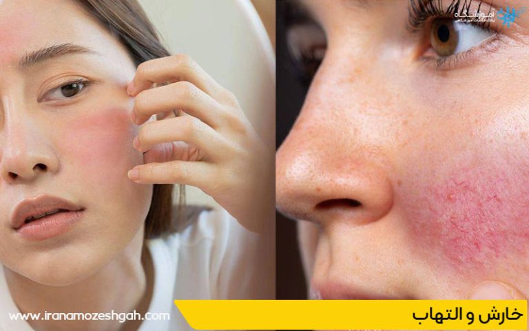 اثرات جانبی احتمالی پاکسازی پوست