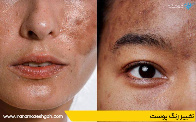 اثرات جانبی احتمالی پاکسازی پوست