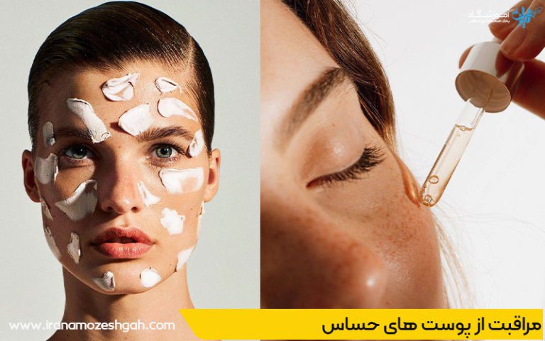 مراقبت از پوست های حساس