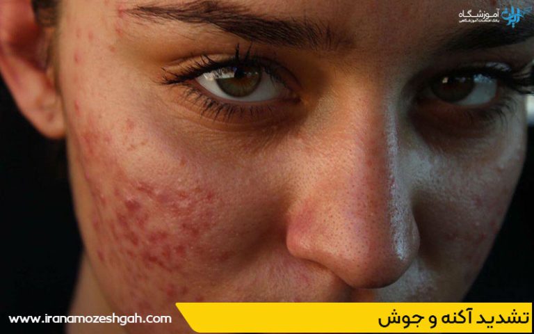 خطرات استفاده از محصولات پاکسازی نامرغوب