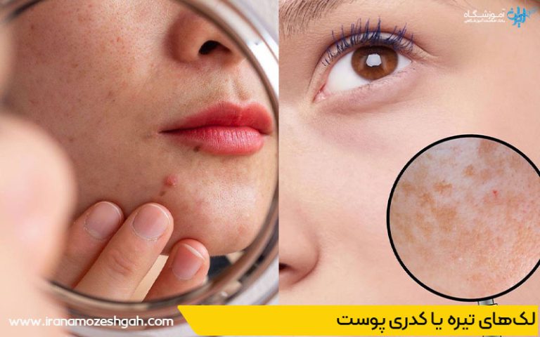 خطرات استفاده از محصولات پاکسازی نامرغوب