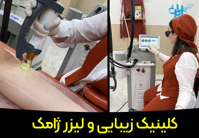 کلینیک لیزر ژامک در اندیشه