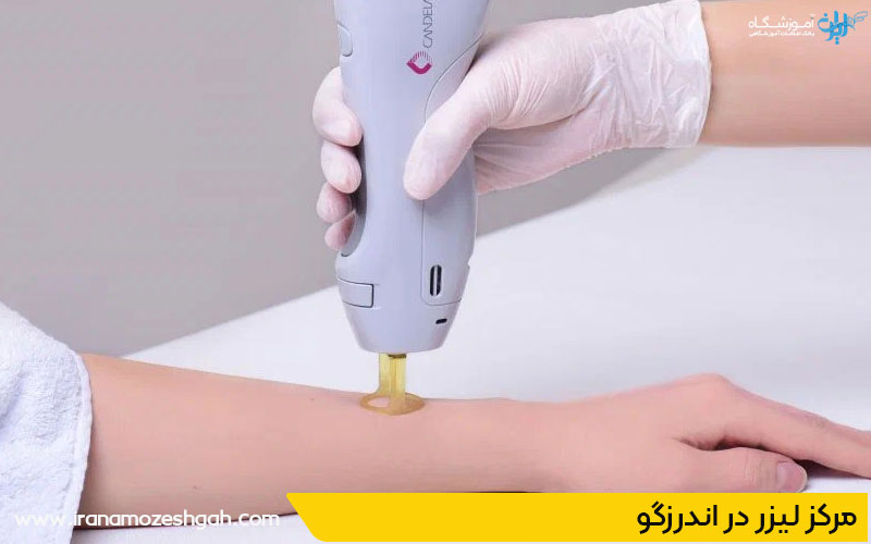 مرکز تخصصی لیزر اندرزگو