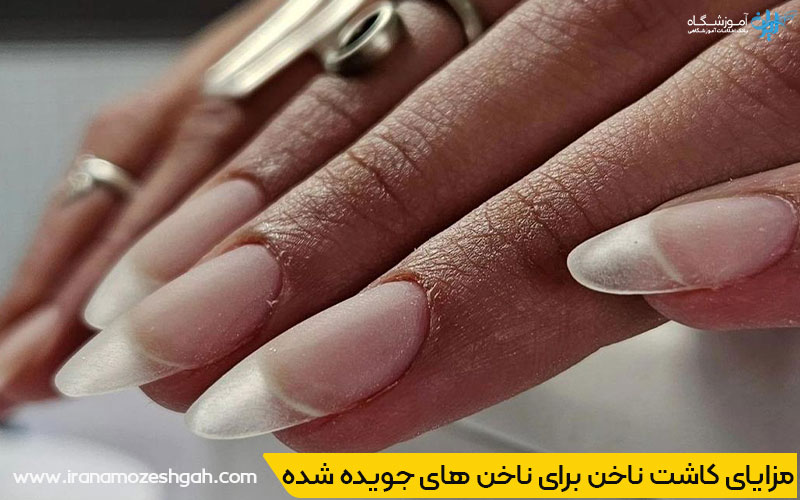 کاشت ناخن برای ناخن های جویده شده و آسیب دیده