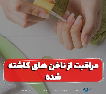 مراقبت از ناخن های کاشته شده