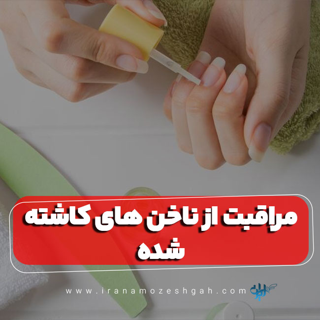 مراقبت از ناخن های کاشته شده