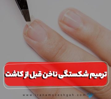 روش‌های ترمیم شکستگی ناخن قبل از کاشت