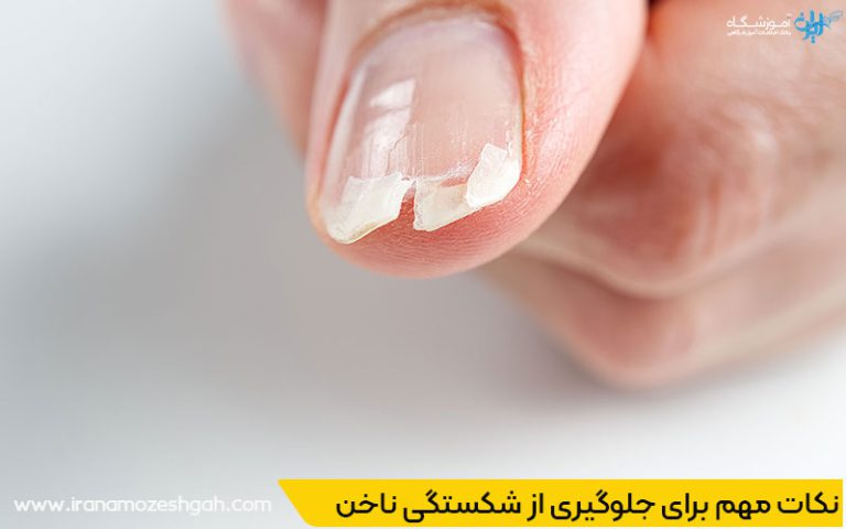 نکات مهم برای جلوگیری از شکستگی ناخن