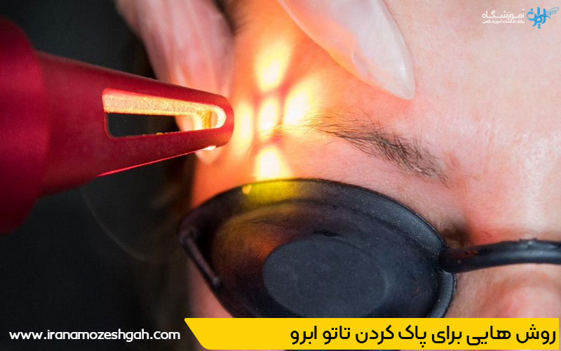 قوی ترین پاک کننده تاتو ابرو