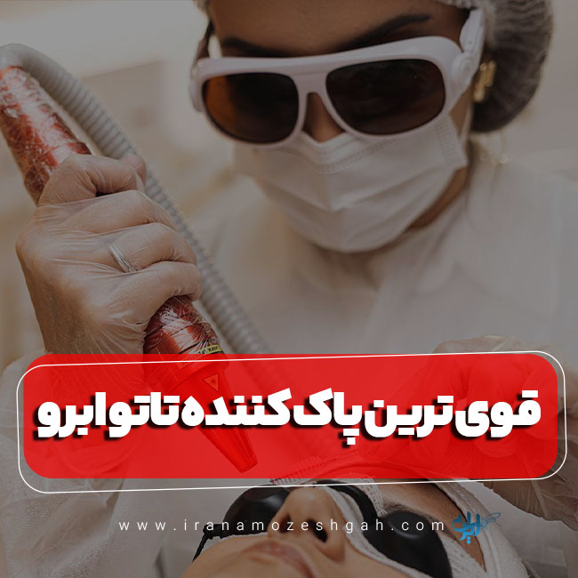قوی ترین پاک کننده تاتو ابرو