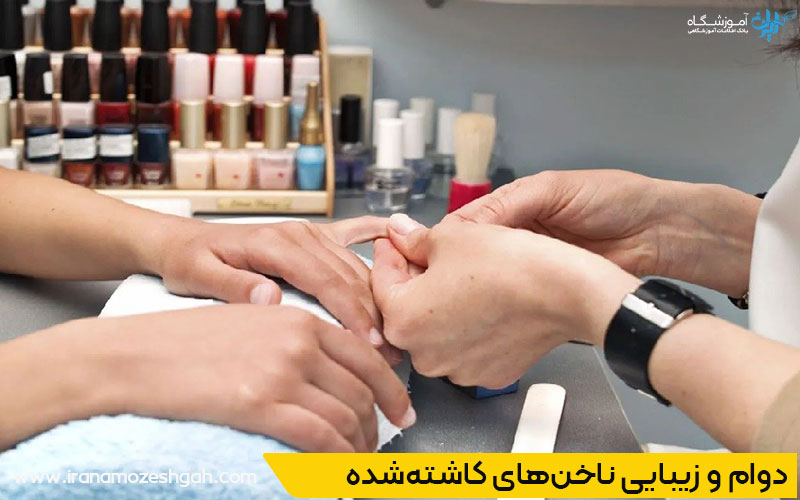  پیشگیری از مشکلات کاشت ناخن