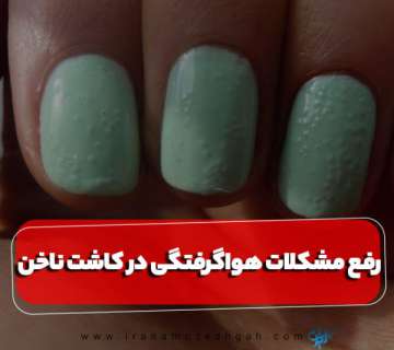 مشکلات هواگرفتگی در کاشت ناخن
