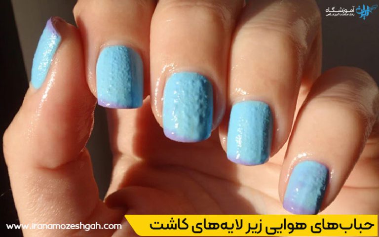 علت‌های اصلی هواگرفتگی در کاشت ناخن