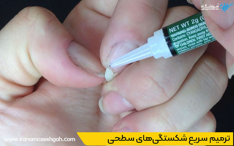 چسبهای مخصوص ناخن برای ترمیم