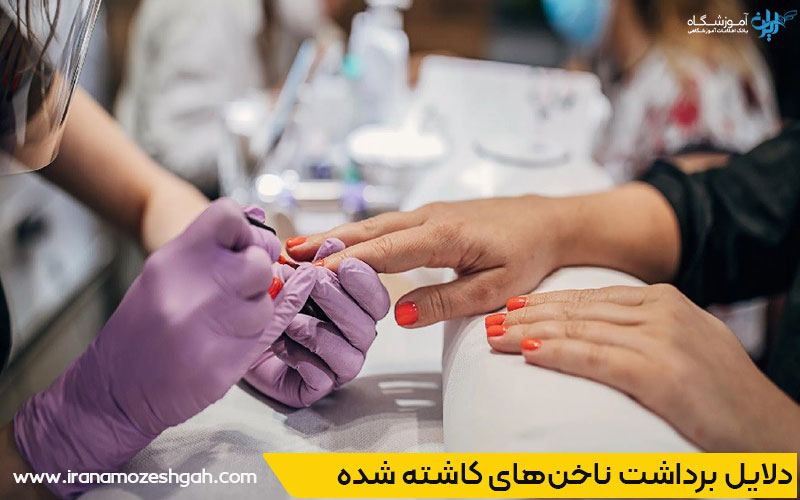 ناخن کاشته‌شده