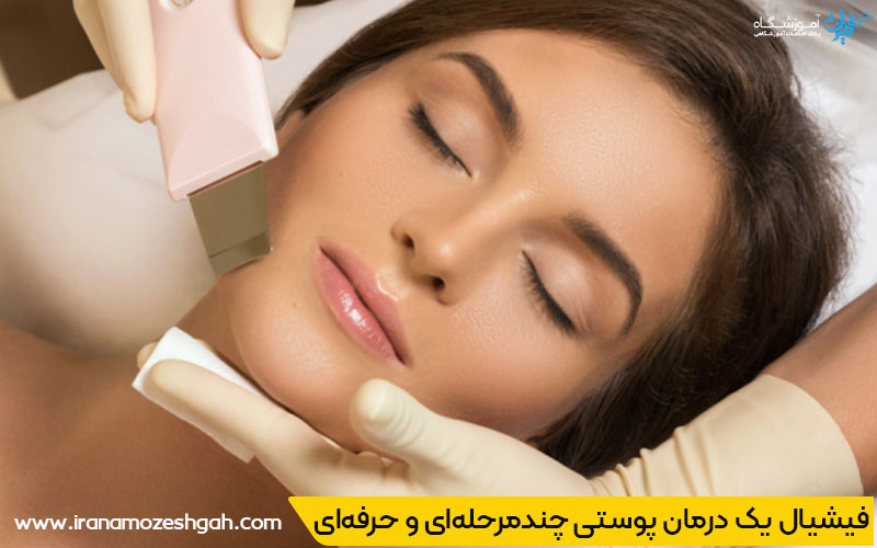 سوالات درباره فیشیال