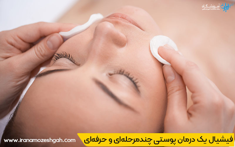 سوالات درباره فیشیال