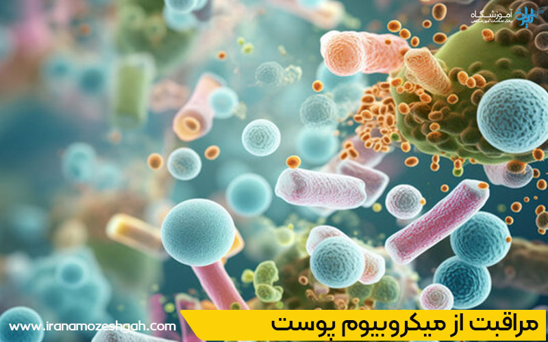 روشهای تقویت میکروبیوم پوست