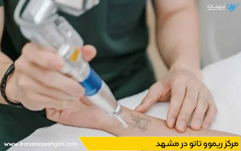 بهترین مرکز ریموو تاتو در مشهد